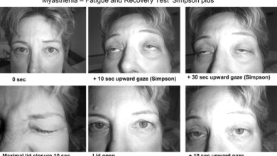 Photo of Что такое глюкометаболический синдром?