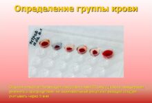 Photo of Диета с учетом группы крови